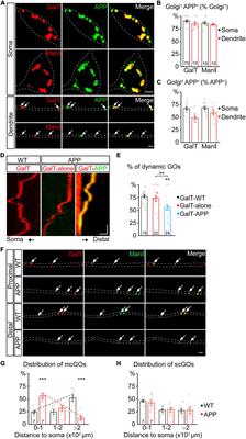 Sunday Driver Mediates Multi-Compartment Golgi Outposts Defects Induced by Amyloid Precursor Protein